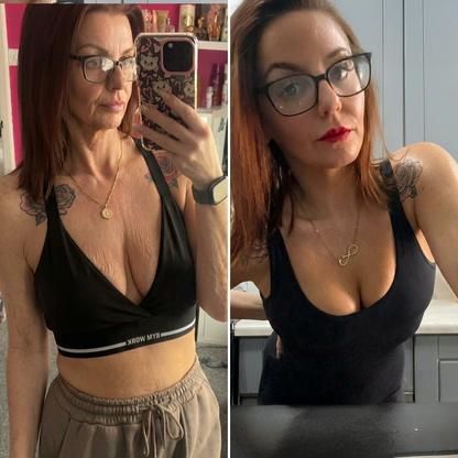 ❤️HISKIN® Mikroneedlová náplast pro podporu objemu, lifting a pevnost prsou