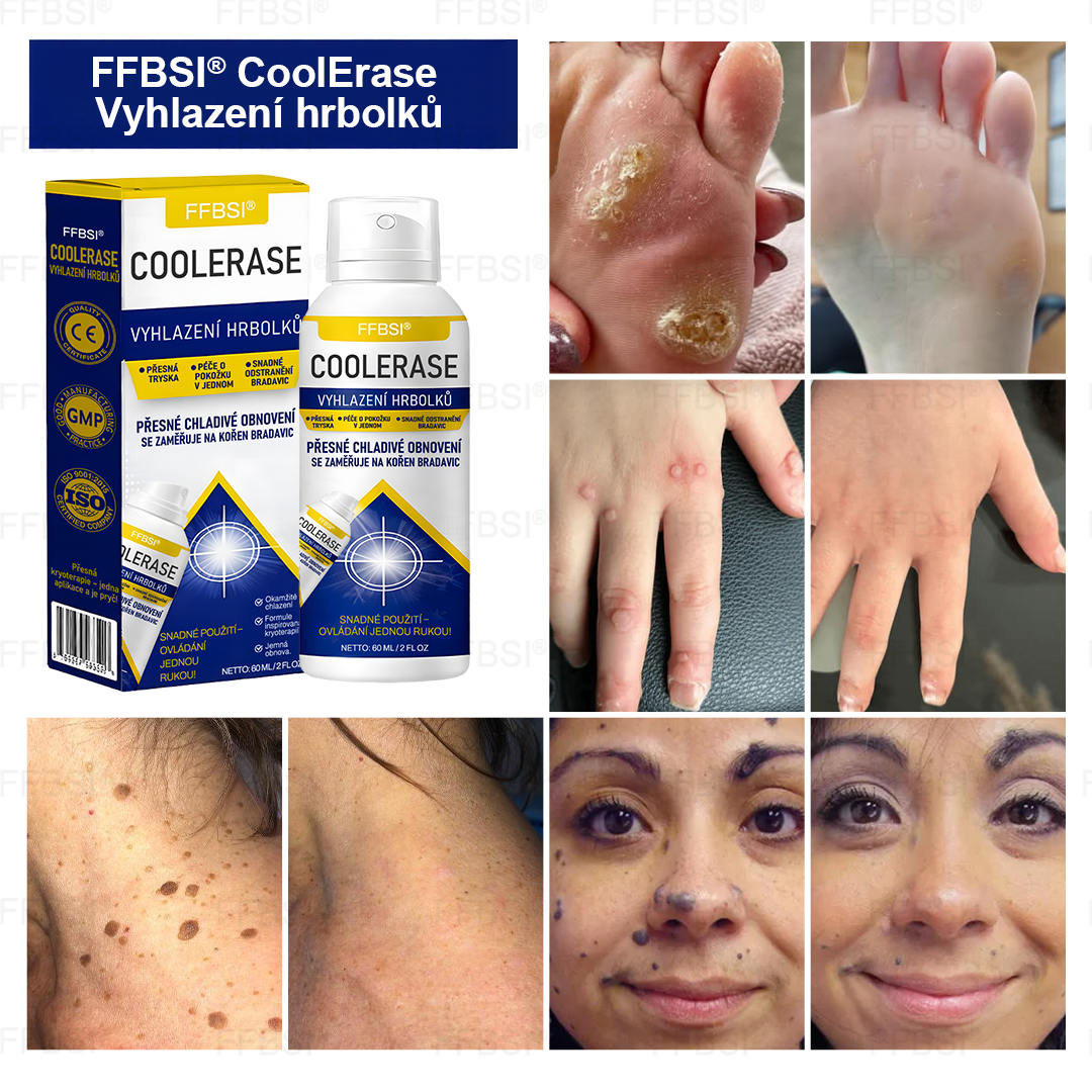 FFBSI® CoolErase Sprej pro regeneraci pokožky (Bradavice, Puchýře, Ekzém, Lupy, Kožní keratózy, Akné, Kožní výrůstky, Jizvy, Mateřská znaménka)💎