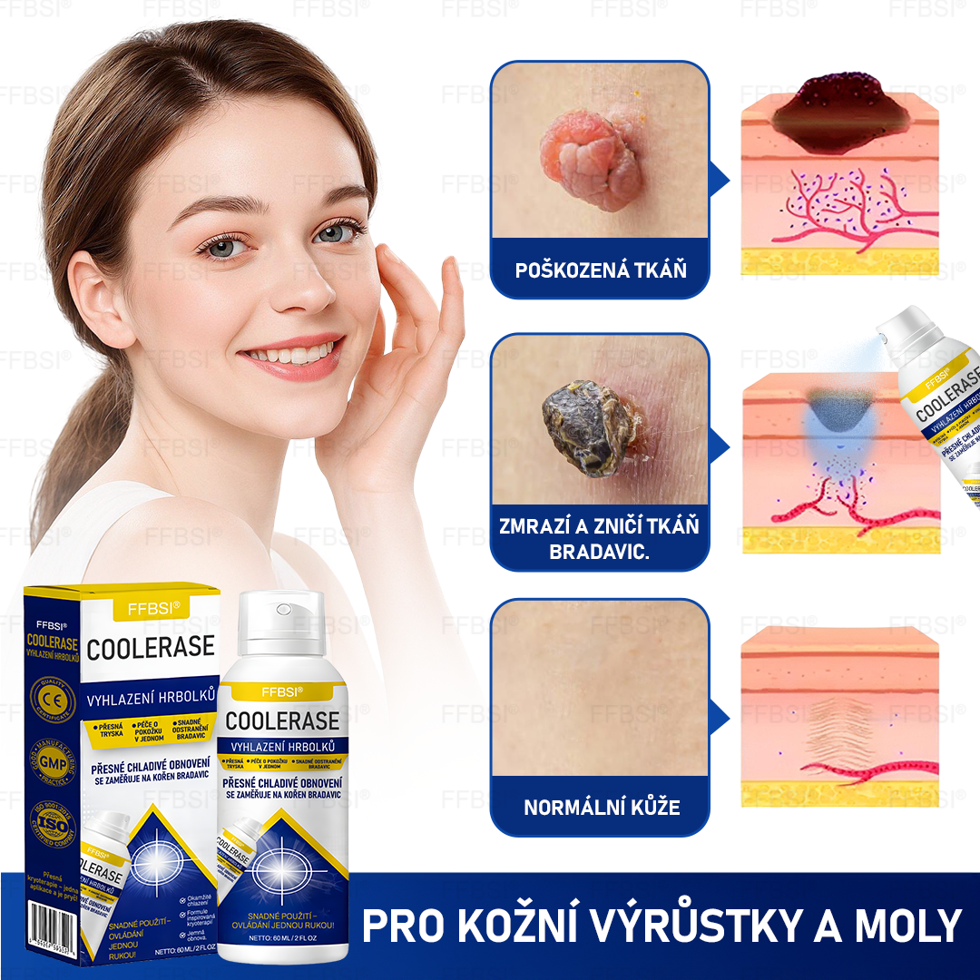 FFBSI® CoolErase Sprej pro regeneraci pokožky (Bradavice, Puchýře, Ekzém, Lupy, Kožní keratózy, Akné, Kožní výrůstky, Jizvy, Mateřská znaménka)💎