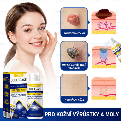 FFBSI® CoolErase Sprej pro regeneraci pokožky (Bradavice, Puchýře, Ekzém, Lupy, Kožní keratózy, Akné, Kožní výrůstky, Jizvy, Mateřská znaménka)💎