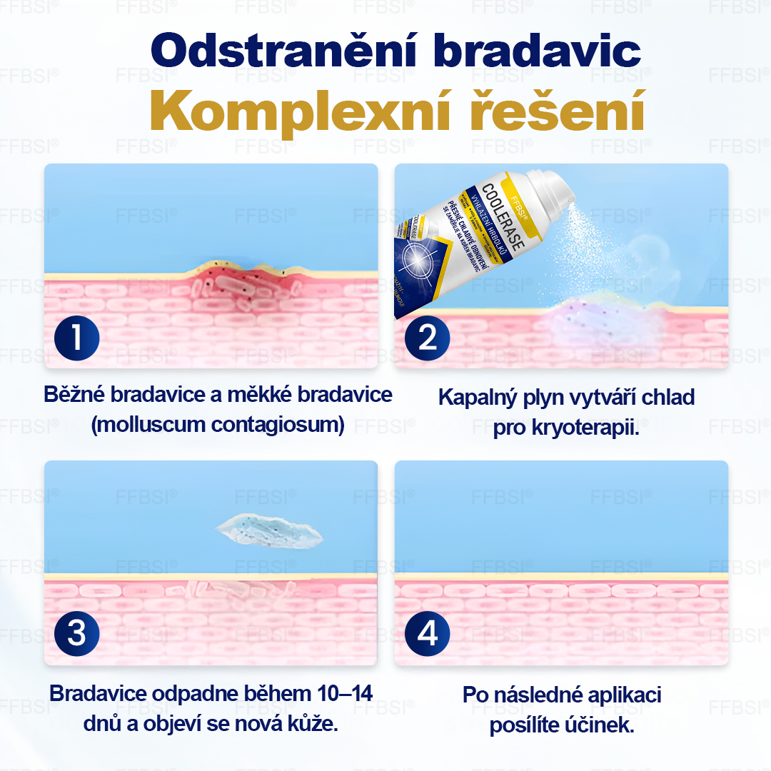 FFBSI® CoolErase Sprej pro regeneraci pokožky (Bradavice, Puchýře, Ekzém, Lupy, Kožní keratózy, Akné, Kožní výrůstky, Jizvy, Mateřská znaménka)💎