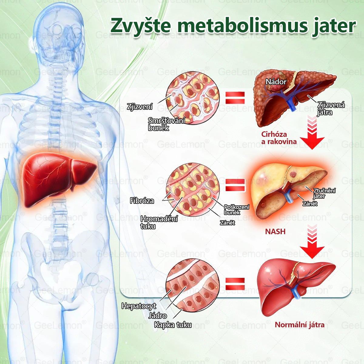 🎁 GeeLemon® Glumasetide 8 v 1 – Revoluční nano mikrojihlová náplast 🇨🇿 1× denně pro podporu hubnutí, více energie a lepší kontrolu chuti k jídlu