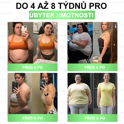 Oficiální obchod 💯 Funutri® 10 v 1 metabolická tvarující náplast s nano mikrojehličkami (Pouze jednou denně, viditelné změny již za 7 dní)  Určeno pro osoby s obezitou, diabetem, spánkovou apnoe