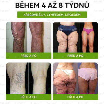 Oficiální obchod 💯 Funutri® 10 v 1 metabolická tvarující náplast s nano mikrojehličkami (Pouze jednou denně, viditelné změny již za 7 dní)  Určeno pro osoby s obezitou, diabetem, spánkovou apnoe