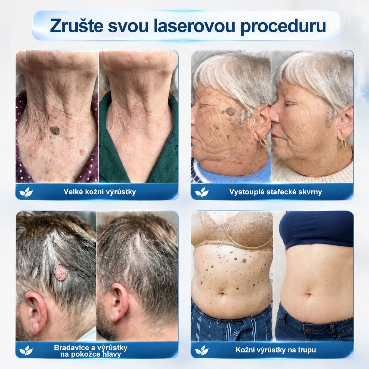 Oficiální značkový obchod | Hiskin® 7denní odstraňovač skvrn a pigmentových skvrn (Bezbolestný rollerball bez jizev)❤️