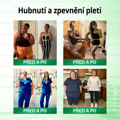 🎁 GeeLemon® Glumasetide 8 v 1 – Revoluční nano mikrojihlová náplast 🇨🇿 1× denně pro podporu hubnutí, více energie a lepší kontrolu chuti k jídlu