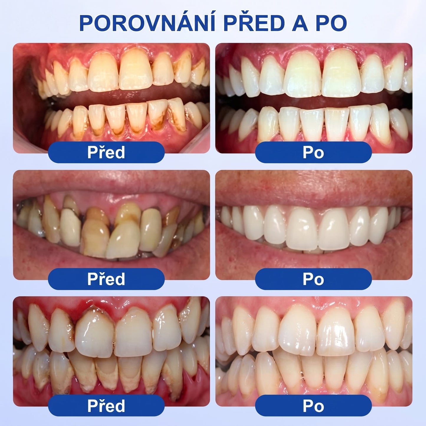 PureShade® 🦷 GumRevive regenerační gel na dásně