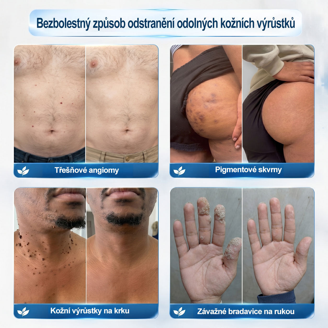 Oficiální značkový obchod | Hiskin® 7denní odstraňovač skvrn a pigmentových skvrn (Bezbolestný rollerball bez jizev)❤️