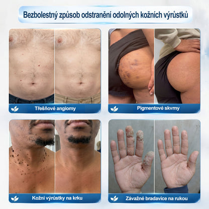 Oficiální značkový obchod | Hiskin® 7denní odstraňovač skvrn a pigmentových skvrn (Bezbolestný rollerball bez jizev)❤️