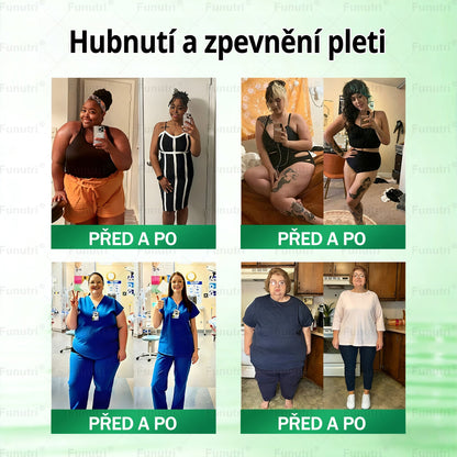 Oficiální obchod 💯 Funutri® 10 v 1 metabolická tvarující náplast s nano mikrojehličkami (Pouze jednou denně, viditelné změny již za 7 dní)  Určeno pro osoby s obezitou, diabetem, spánkovou apnoe