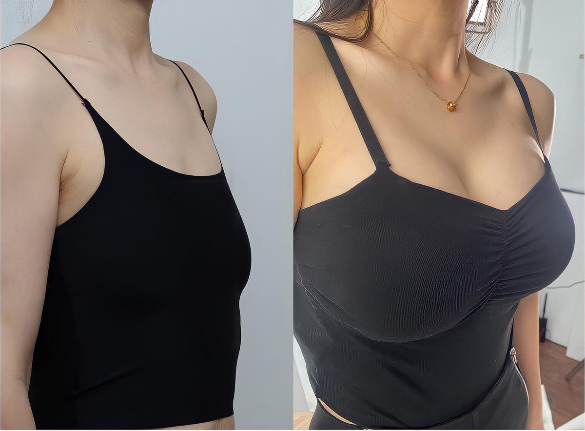 ❤️HISKIN® Mikroneedlová náplast pro podporu objemu, lifting a pevnost prsou
