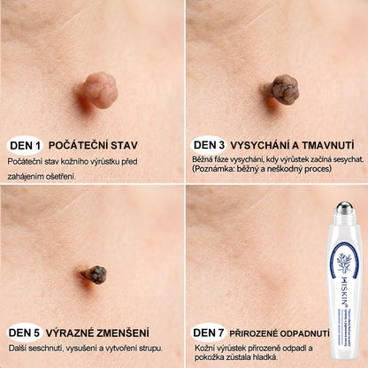 Oficiální značkový obchod | Hiskin® 7denní odstraňovač skvrn a pigmentových skvrn (Bezbolestný rollerball bez jizev)❤️