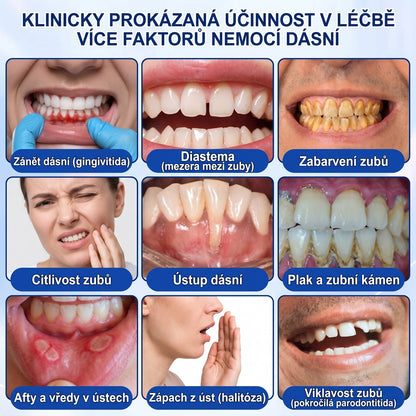 PureShade® 🦷 GumRevive regenerační gel na dásně