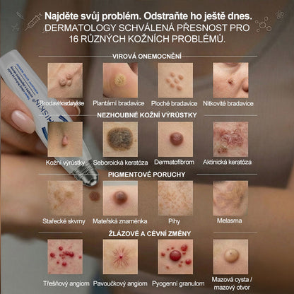 Oficiální značkový obchod | Hiskin® 7denní odstraňovač skvrn a pigmentových skvrn (Bezbolestný rollerball bez jizev)❤️