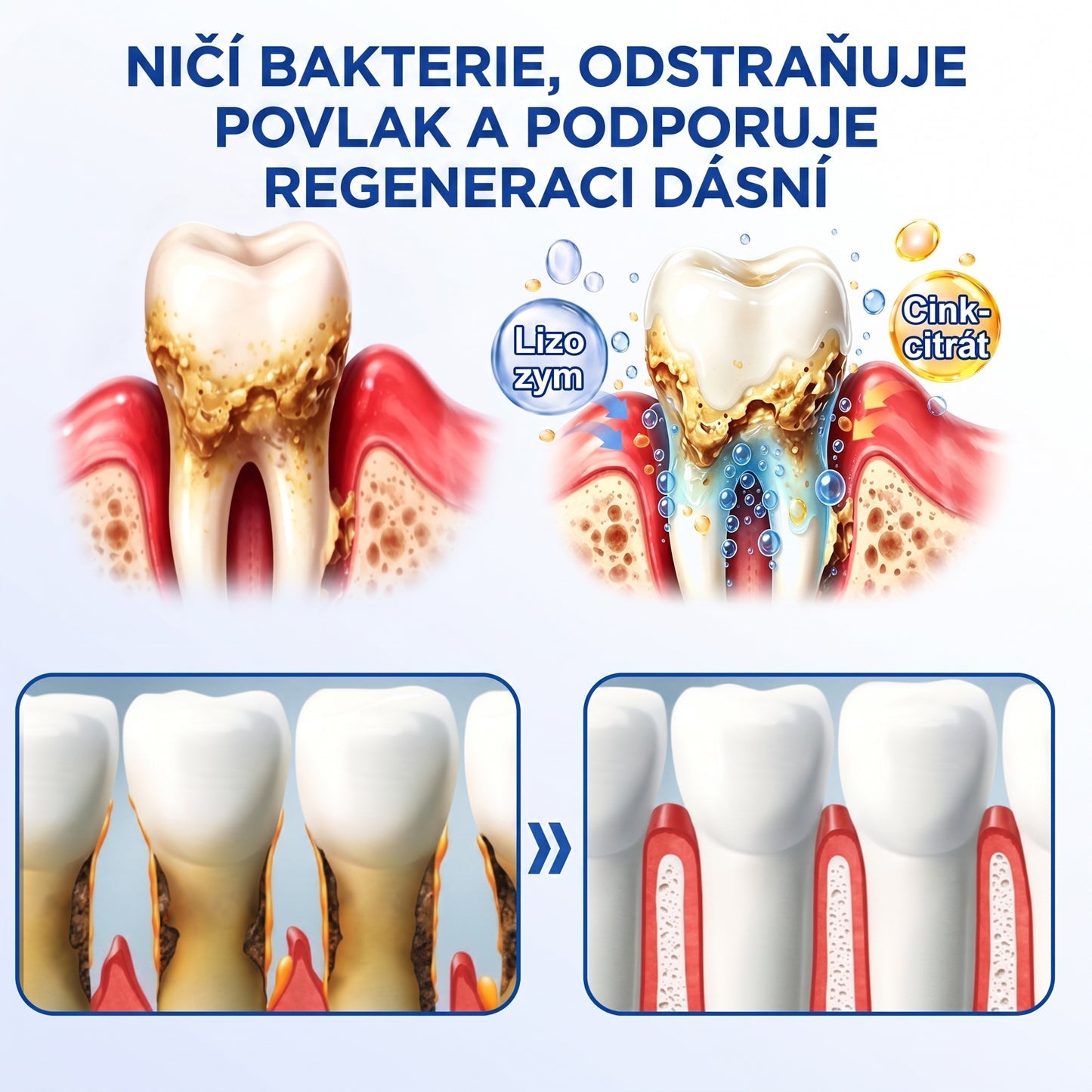 PureShade® 🦷 GumRevive regenerační gel na dásně