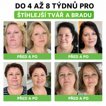 Oficiální obchod 🍋 Funutri® 10 v 1 metabolická tvarující náplast s nano mikrojehličkami (Pouze jednou denně, viditelné změny již za 7 dní)  Určeno pro osoby s obezitou, diabetem, spánkovou apnoe