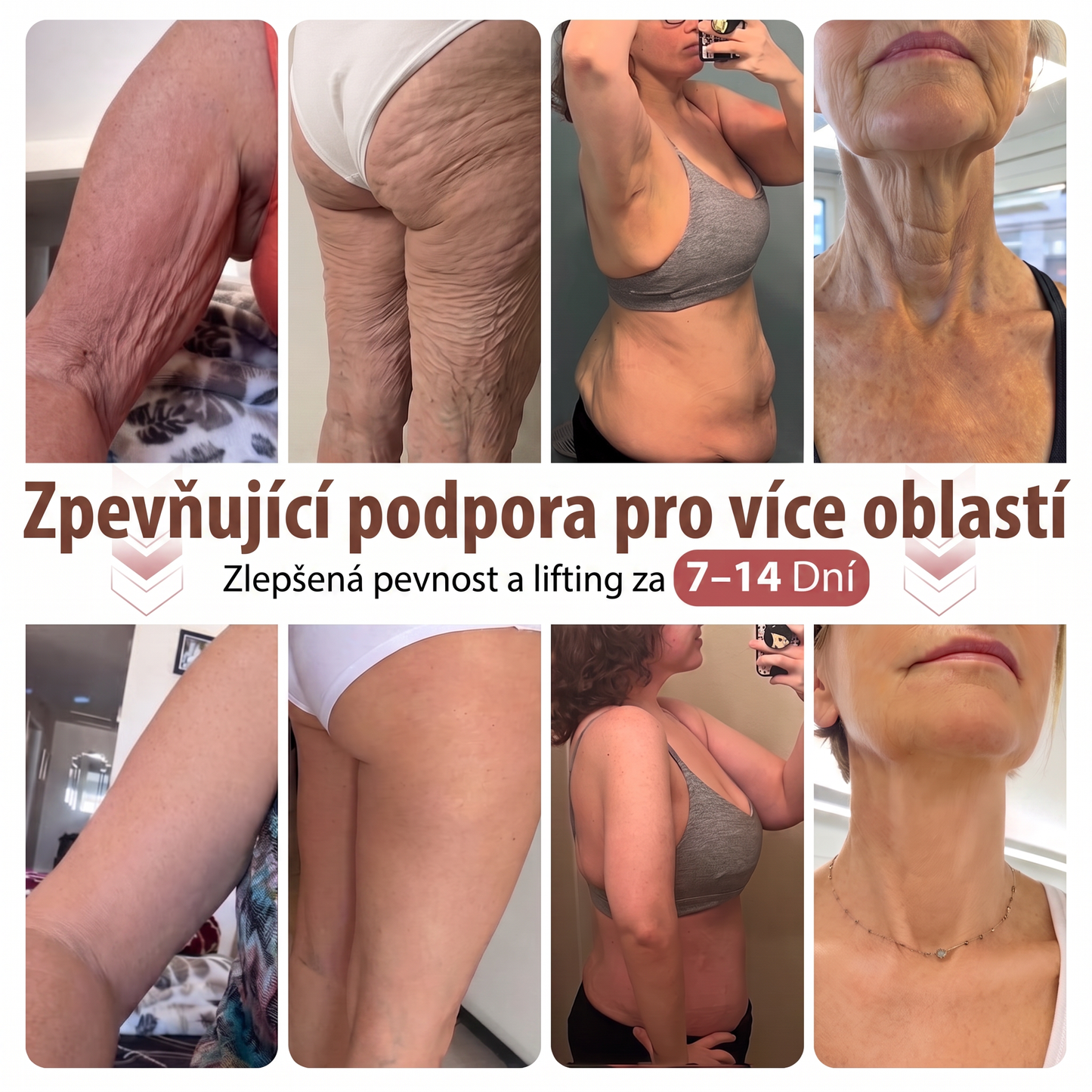 ❤️HISKIN® Mikroneedlová náplast pro podporu objemu, lifting a pevnost prsou