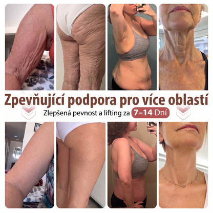 ❤️HISKIN® Mikroneedlová náplast pro podporu objemu, lifting a pevnost prsou