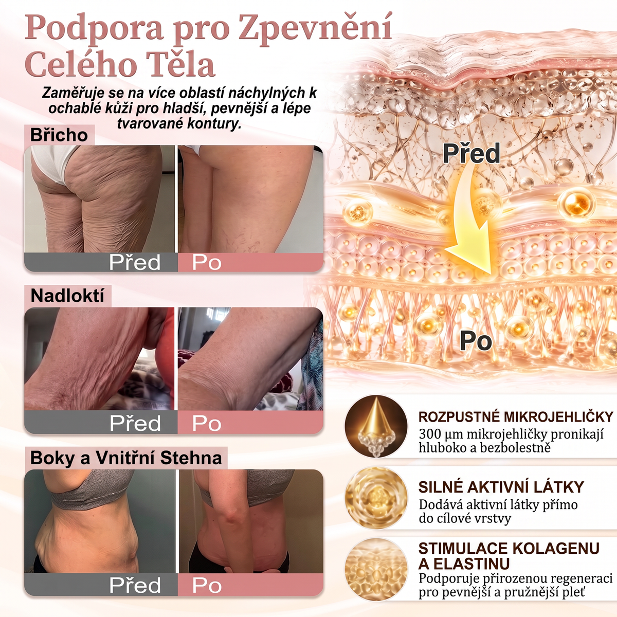 ❤️HISKIN® Mikroneedlová náplast pro podporu objemu, lifting a pevnost prsou