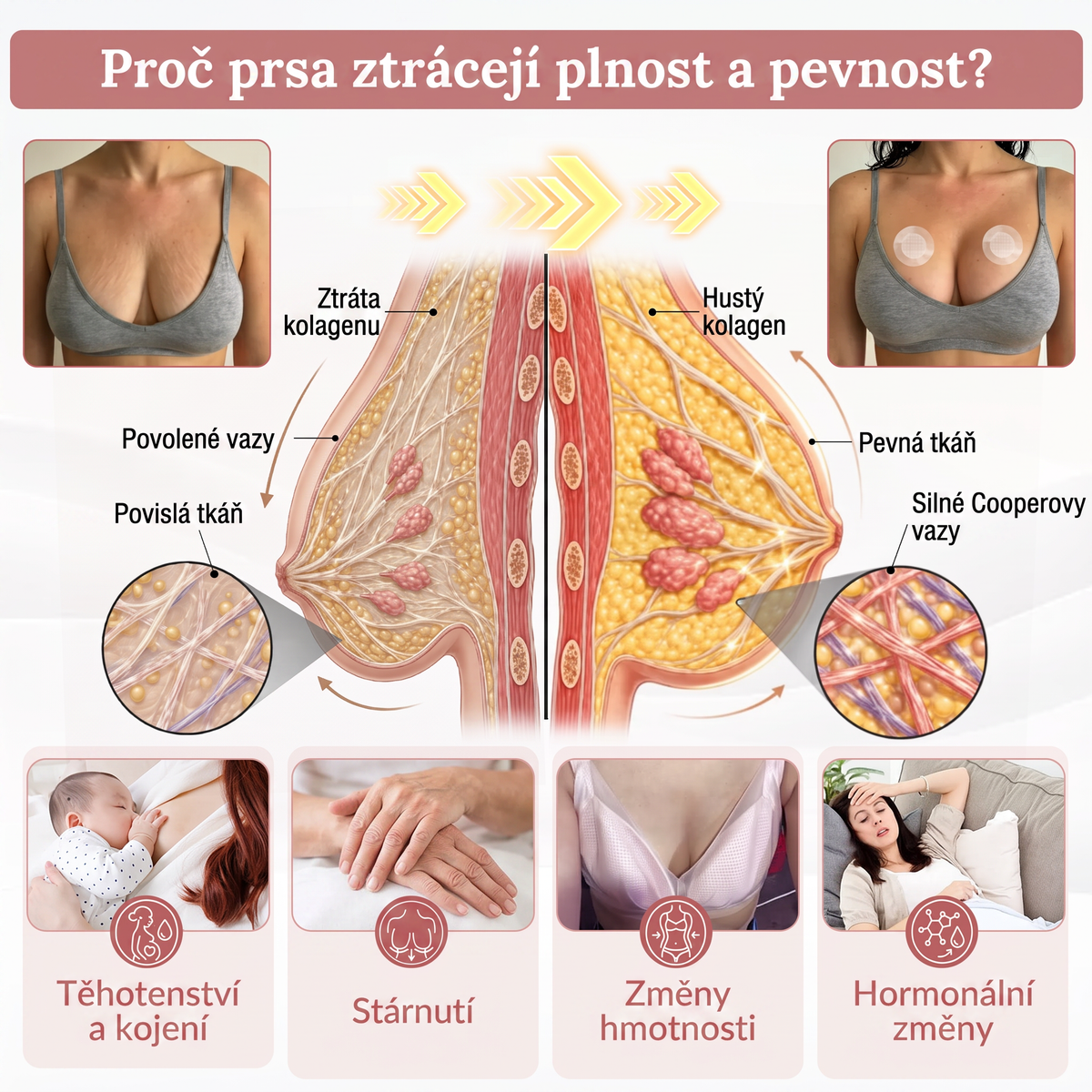 ❤️HISKIN® Mikroneedlová náplast pro podporu objemu, lifting a pevnost prsou