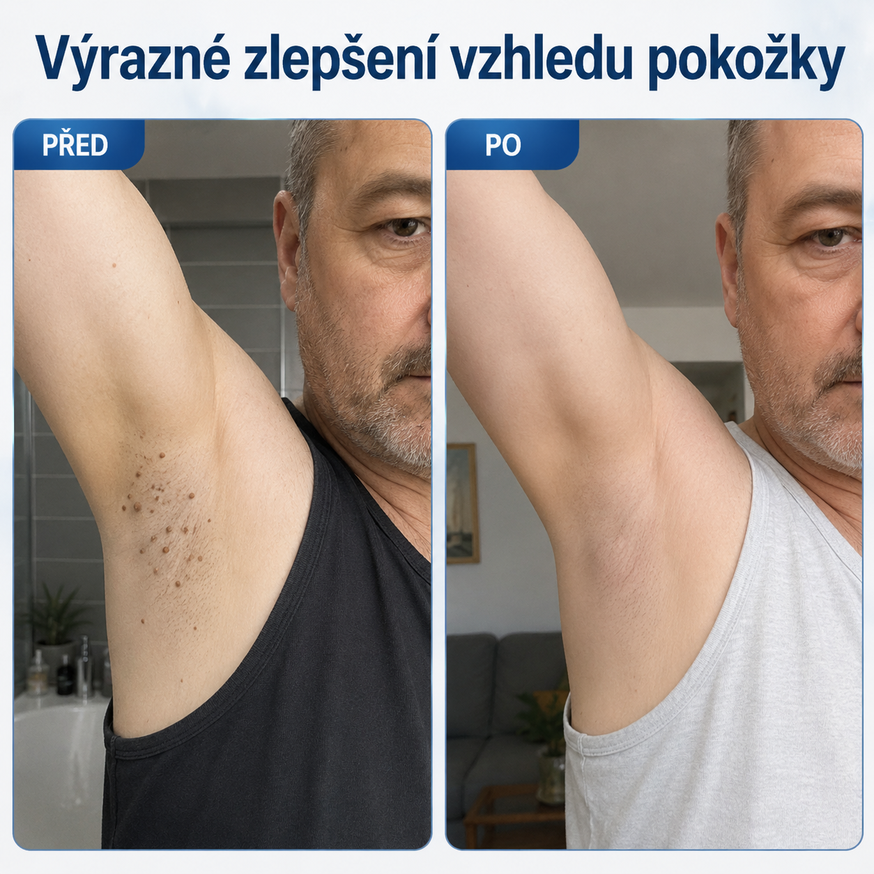 🎁 Oficiální značkový obchod🎁 Hiskin® 7denní odstraňovač skvrn a pigmentových skvrn