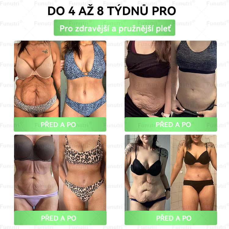 Oficiální obchod 💯 Funutri® 10 v 1 metabolická tvarující náplast s nano mikrojehličkami (Pouze jednou denně, viditelné změny již za 7 dní)  Určeno pro osoby s obezitou, diabetem, spánkovou apnoe