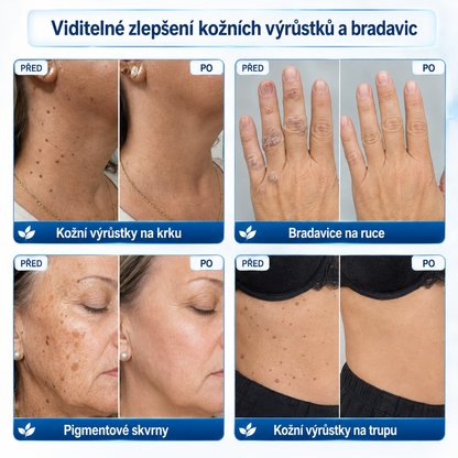 🎁 Oficiální značkový obchod🎁 Hiskin® 7denní odstraňovač skvrn a pigmentových skvrn