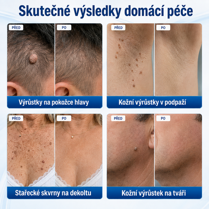 🎁 Oficiální značkový obchod🎁 Hiskin® 7denní odstraňovač skvrn a pigmentových skvrn