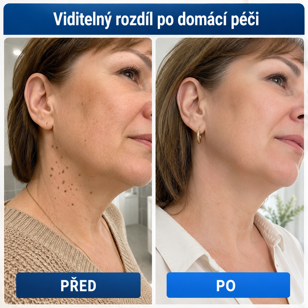 🎁 Oficiální značkový obchod🎁 Hiskin® 7denní odstraňovač skvrn a pigmentových skvrn
